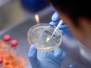 Researchers are testing whether the tuberculosis vaccine could either reduce the risk of being infected by the coronavirus, or limit the severity of the symptoms | © AFP/File | DOUGLAS MAGNO