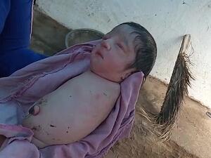 A baby girl has left doctors and family members baffled in India after she was born without arms or legs (SWNS/Dailymail)