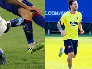 الندوب واضحة على ساق ميسي جراء تدخل كارلوس العنيف