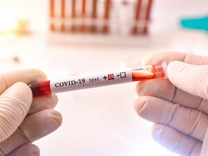 Coronavirus Test. (Shutterstock/ File Photo)