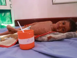 The long conflict has devastated the health system and displaced 3.3 million people who live in camps where cholera and other diseases are rife. ESSA AHMED / AFP