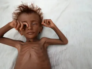 Dozen civilians, mostly women and children, have been killed when Saudi military aircraft struck a residential area in Yemen (Twitter)