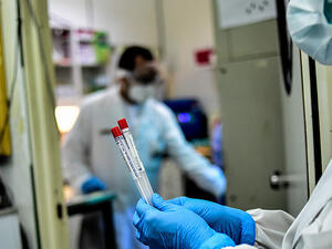 الحصيلة الحقيقية للإصابات تتجاوز  الأرقام الرسمية