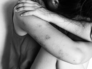 (Shutterstock/ File Photo)