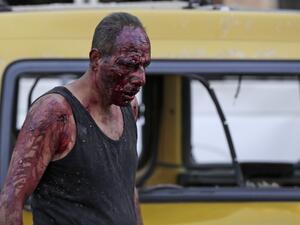 A wounded man walks at the port near the scene of an explosion in the Lebanese capital Beirut on August 4, 2020. Two huge explosion rocked the Lebanese capital Beirut, wounding dozens of people, shaking buildings and sending huge plumes of smoke billowing into the sky. Lebanese media carried images of people trapped under rubble, some bloodied, after the massive explosions, the cause of which was not immediately known.  ANWAR AMRO / AFP