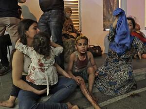 Wounded people wait to received help outside a hospital following an explosion in the Lebanese capital Beirut on August 4, 2020. Two huge explosion rocked the Lebanese capital Beirut, wounding dozens of people, shaking buildings and sending huge plumes of smoke billowing into the sky. Lebanese media carried images of people trapped under rubble, some bloodied, after the massive explosions, the cause of which was not immediately known.  IBRAHIM AMRO / AFP
