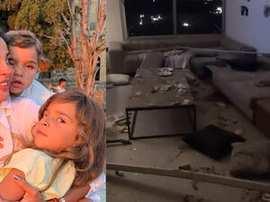 40 Stitches in Her Face! The Full Story of What Happened With Nadine Njiem at the Moment of Blast
