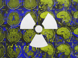 Radiation exposure (Design by Rami Khouri) 