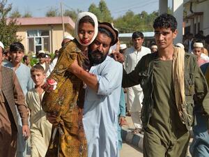 An injured youth (C-L) is carried to a hospital following a car bomb attack that targeted a government building, in the Ghani Khel district of Nangarhar province, about 35 km from Jalalabad on October 3, 2020. At least 15 people were killed and more than 30 others wounded in a car bomb attack that targeted a government building in eastern Afghanistan on October 3, officials said.  NOORULLAH SHIRZADA / AFP