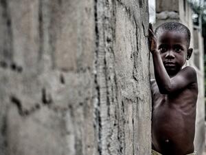 Nigerian boy suffering from malnutrition. (Shutterstock/ File Photo)