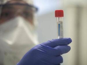 فرنسا تسجّل أول إصابة بالطفرة البريطانية من كوفيد-19