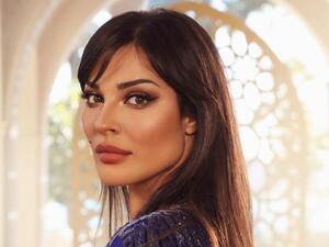 Nadine Njeim Shares First Footage of Her Unrecognizable SMASHED Face Right After Beirut Explosion (Pictures)