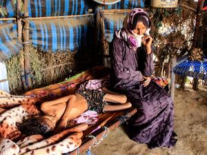 A Yemeni woman sits by the bedside of 10-year-old girl Ahmadia Abdo, who weighs ten kilograms due to acute malnutrition, at a camp for the internally displaced in the northern Hajjah Governorate, on January 23, 2021. About 400,000 children under the age of five are in danger of dying of acute malnutrition in war-torn and impoverished Yemen, UN agencies warned. ESSA AHMED / AFP