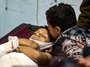 A Yemeni boy kisses the forehead of a killed youngster, following a reported mortar shell attack on the country's third city of Taez, on February 20, 2021. Yemen is engulfed in a bloody power struggle that erupted in 2014 between its government, supported by Saudi Arabia, and Iran-backed Huthi rebels, who control the capital Sanaa and most of the north. AHMAD AL-BASHA / AFP