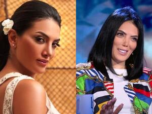 Her Nose Is Boneless! Doctors To Repair Horeya Farghaly's Nose by Using Her Chest Bones in Chicago