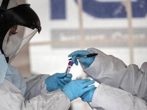 عدد حالات الإصابة بفيروس كورونا في العالم بلغ على ما يربو 108.16 مليون شخص