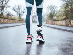 prosthetic limbs
