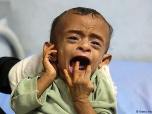 Spare a thought for the Yemeni kids 