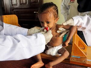 Yemen is accused of violating children's rights.