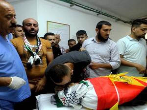  أكثر من 10 مواطنين أصيبوا بالرصاص الحي والمعدني المغلف بالمطاط