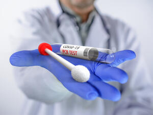 1,061 virus cases were recorded