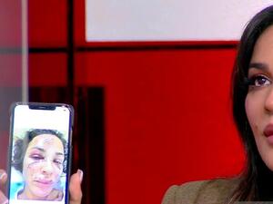 Nadine Njeim smashed face bruised Beirut Blast