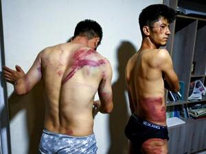 Two Afghan journalists were left with ugly welts and bruises after being beaten and detained for hours by Taliban enforcers for covering a protest in the Afghan capital Kabul