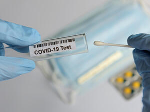 Jordan reported high Covid-19 cases compared with last months