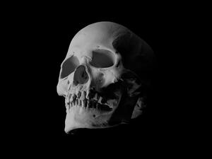 Human skull on uninhabited Caribbean island shows evidence of leprosy