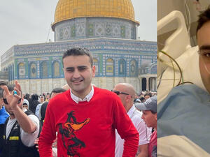 CZN Burak
