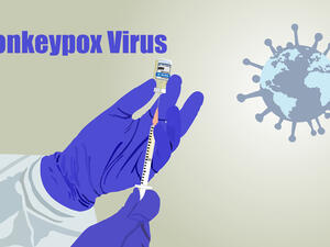 Monkeypox virus. (Shutterstock/ edited by Al-Bawaba News) Monkeypox virus