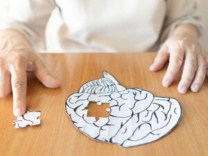 Alzheimer's 