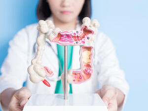 Colorectal Cancer