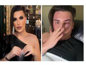 زعم الشاب المتحول جنسياً ستهر منذر  أن الذين اعتدوا عليه كانوا يحاولون التحرش به 