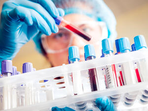 cancer detection