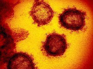 The electron virus 