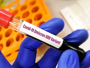 الكويت ترصد متحور "XBB.1.5" من فيروس كورونا