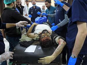 A wounded man lies at a hospital following a deadly earthquake that shook Syria at dawn on February 6, 2023 in Aleppo's Salaheddine district.  (Photo by AFP) earthquake