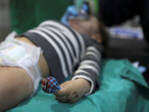 A surgery team operates on a child rescued from the rubble of a building at a hospital in the town of Harim in Syria's rebel-held northwestern Idlib province. (Photo by Aaref WATAD / AFP) earthquake