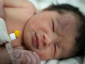 A newborn baby who was found still tied by her umbilical cord to her mother and pulled alive from the rubble of a home in northern Syria following a deadly earthquake, receives medical care, at a clinic in Afrin, on February 7, 2023. The infant is the sole survivor of her immediate family, the rest of whom were all killed when a 7.8-magnitude quake that struck Syria and neighbouring Turkey flattened the family home in the rebel-held town of Jindayris, cousin Khalil al-Suwadi said. (Photo by Rami al SAYED / AFP) baby aya