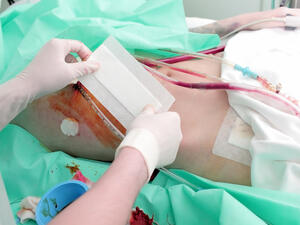 اردني يبيع كليته في تركيا