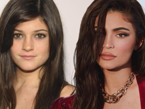 Kylie says she has not done many plastic surgeries
