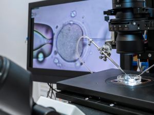 طبيب البوابة: هل فات موعد تجميد البويضات؟