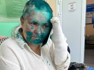 هل نفذ قديروف تهديده لها؟.. ضرب وحشي يغير ملامح صحافية روسية في الشيشان
