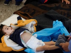 أطفال غزة يموتون جوعا