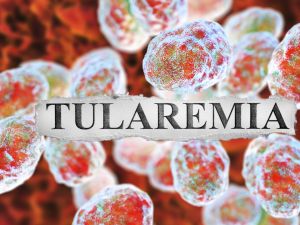Tularemia disease. (Shutterstock/ edited by Al Bawaba) Tularemia disease