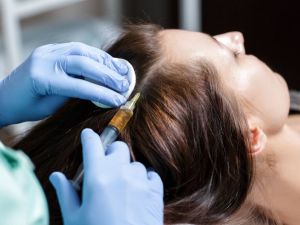 ما حقيقة إنبات الشعر عبر حقن البلازما وهل هي من الحلول الفعالية لاستعادة كثافته