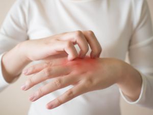 Shutterstock skin allergies