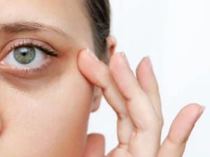 Shutterstock dark circles