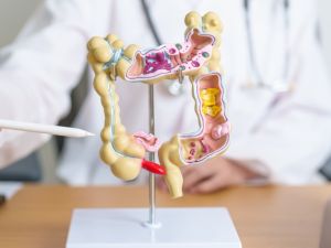 Shutterstock colon cancer